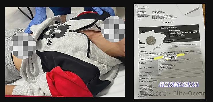 澳华男吃麻辣烫吃出烟头，却被6人围殴？疑店方回应：打没打你心里有数（组图） - 5