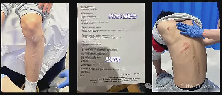 澳华男吃麻辣烫吃出烟头，却被6人围殴？疑店方回应：打没打你心里有数（组图） - 4