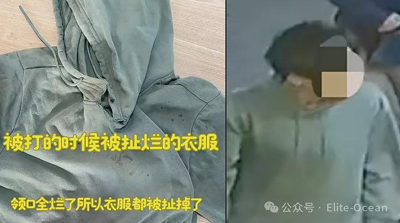 澳华男吃麻辣烫吃出烟头，却被6人围殴？疑店方回应：打没打你心里有数（组图） - 11