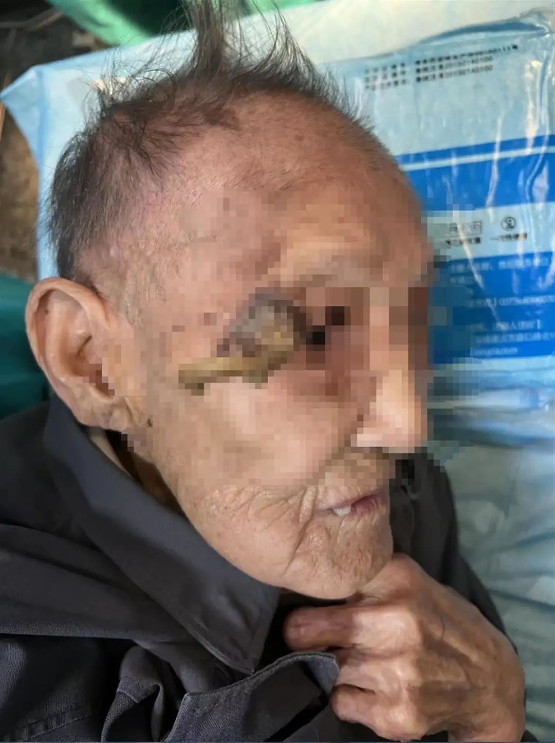 太狠了！上海一老人拿起剪刀，居然把自己身上的…剪掉了！医生也傻眼了…（组图） - 9
