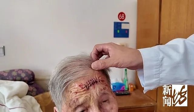 太狠了！上海一老人拿起剪刀，居然把自己身上的…剪掉了！医生也傻眼了…（组图） - 7