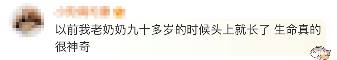 太狠了！上海一老人拿起剪刀，居然把自己身上的…剪掉了！医生也傻眼了…（组图） - 12