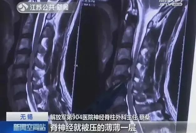 ​突然瘫痪！19岁小伙病房痛哭，医生：这个常见动作害了太多人，赶紧自查（组图） - 3