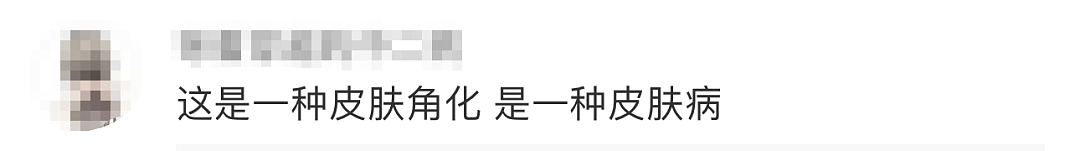 太狠了！上海一老人拿起剪刀，居然把自己身上的…剪掉了！医生也傻眼了…（组图） - 16