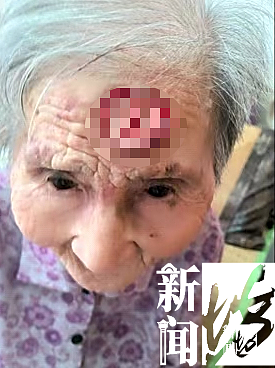 太狠了！上海一老人拿起剪刀，居然把自己身上的…剪掉了！医生也傻眼了…（组图） - 2