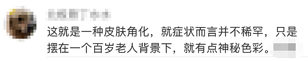 太狠了！上海一老人拿起剪刀，居然把自己身上的…剪掉了！医生也傻眼了…（组图） - 17