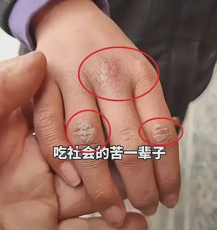 她泡在水里48小时,双手交叉紧握,大人却在吃席,受虐细节曝出(组图) - 4