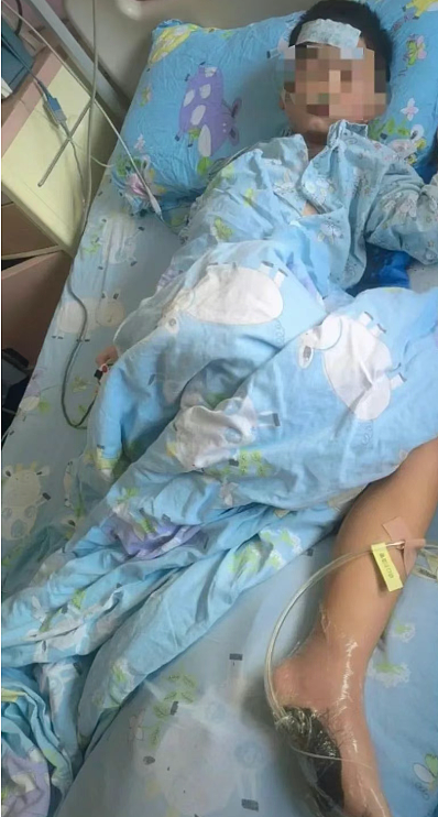 6岁男孩沙滩光脚踩到死鱼次日紧急送进ICU，医生提醒：警惕这种“海鲜刺客”，死亡率最高56%（组图） - 1