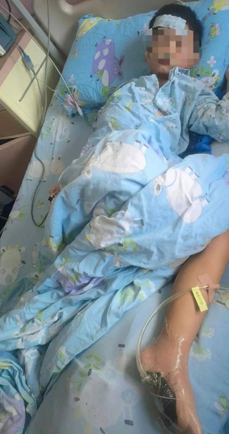 6岁男孩海边赤脚玩耍，踩到死鱼后发烧进ICU（图） - 1