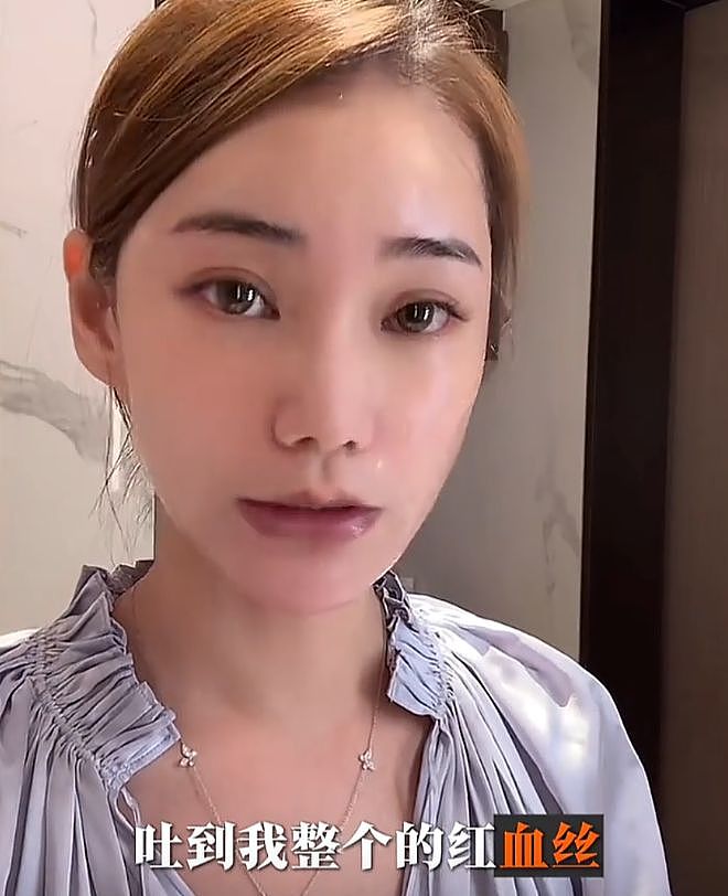 马筱梅面相开始变化，疲惫浮肿有孕相，提及大S子女感慨宝妈都懂（组图） - 5