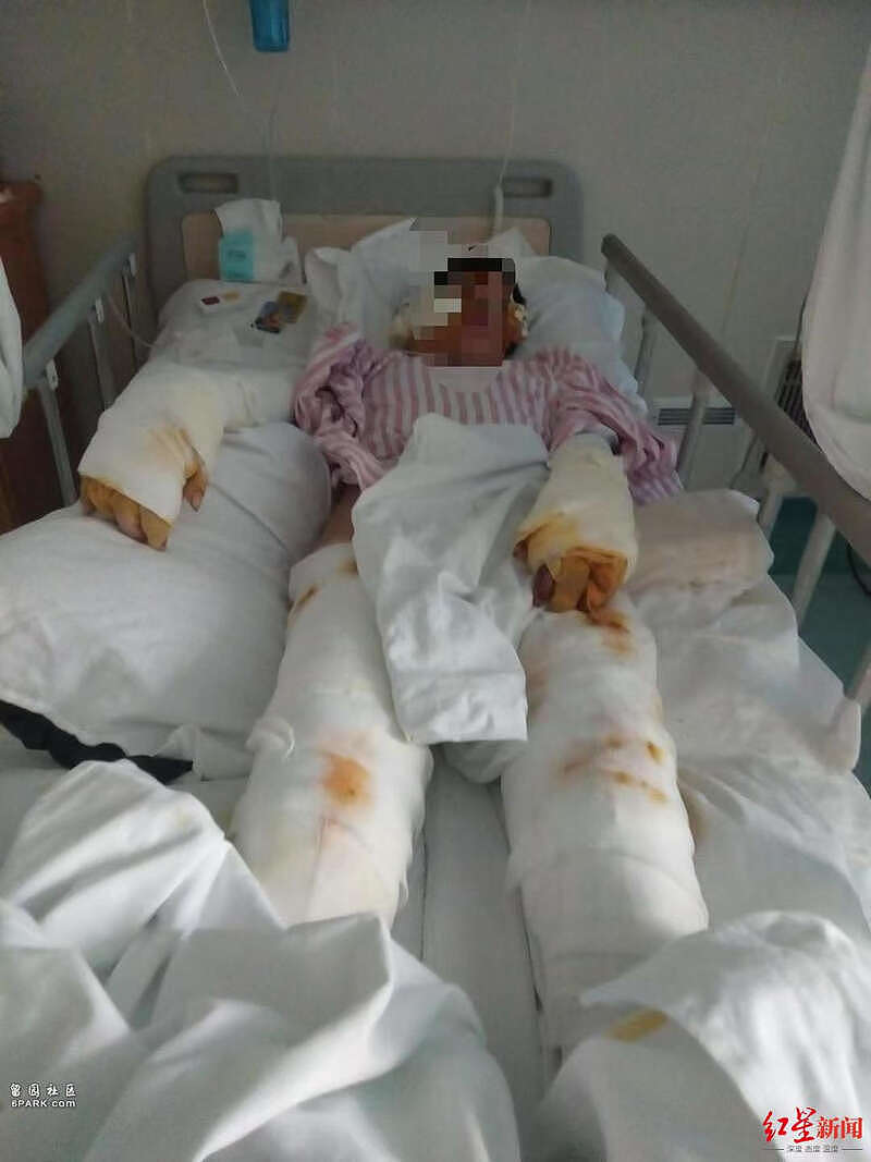 男子捅刺并泼硫酸致女子重伤获死刑，被害女子：至今生活难自理（组图） - 2