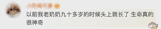 太狠了！98岁老人拿起剪刀，居然把自己身上的这东西剪掉了！医生傻眼了（组图） - 6