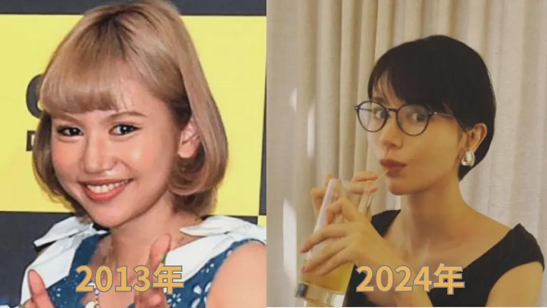 日本女星自曝14岁开始整容，至今脸已更新28个版本！坦言持续动刀是想刷新纪录（组图） - 25