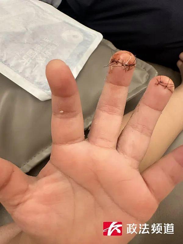 2岁男童在餐厅用餐期间被割伤,家属索赔49000元,商家:家长未尽到监护责任(组图) - 2