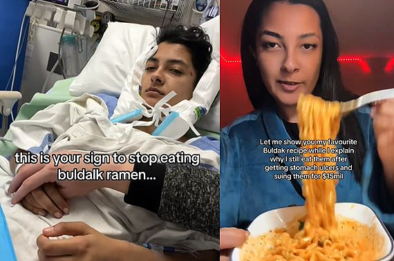 美女网红狂吃韩国火鸡面得胃溃疡索赔7000万！专家：有人辣到尿血、肾结石…（组图） - 1