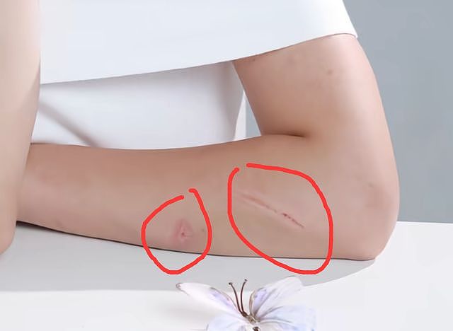 孟村出轨男杀妻后续，弟弟晒家暴照触目惊心，父母伤心欲绝病倒了（组图） - 8