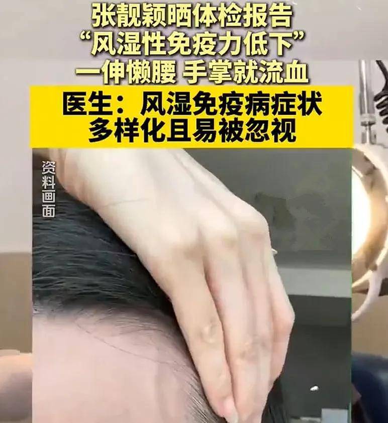 多位明星自曝身体出状况，有人吃素有人暴瘦，网友劝他们好好吃饭（组图） - 15