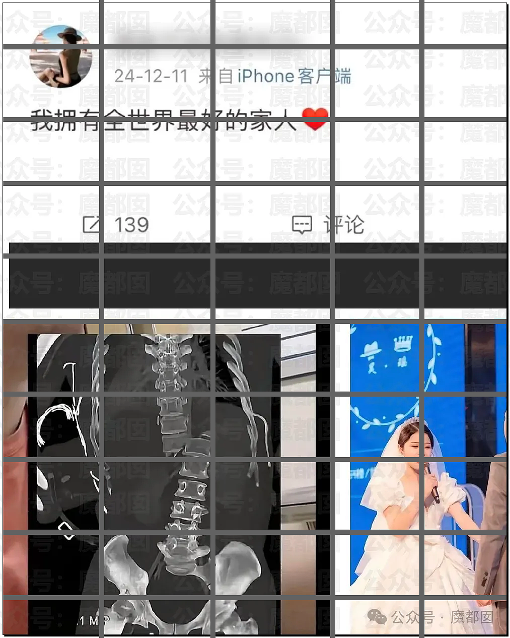 触目惊心！河北25岁宝妈被家暴致