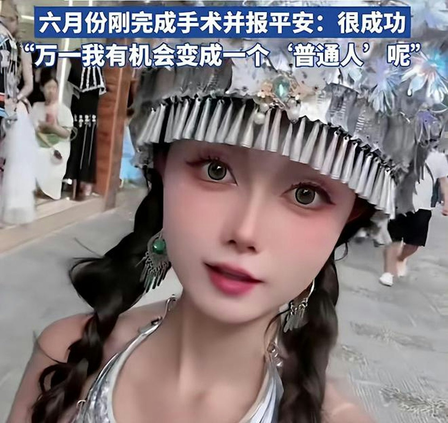 28岁女抗癌博主去世　面试上空姐却发现患全球仅400例罕见病（组图） - 5