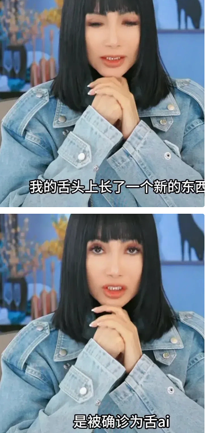 56岁张咪舌癌术后287天重返舞台： 唱歌无歌词只旋律！ 三度患癌， 切掉半个舌头（组图） - 1