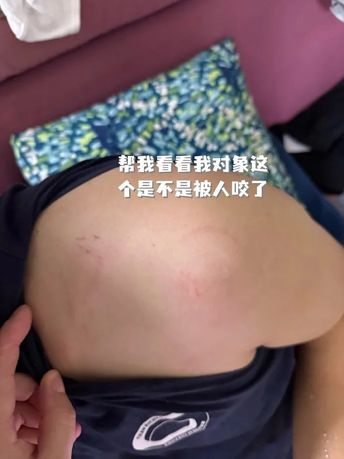 【爆笑】老公肩膀上有个牙印，不是我咬的！网友劝离婚：她牙挺齐的，姿势也到位...（组图） - 3