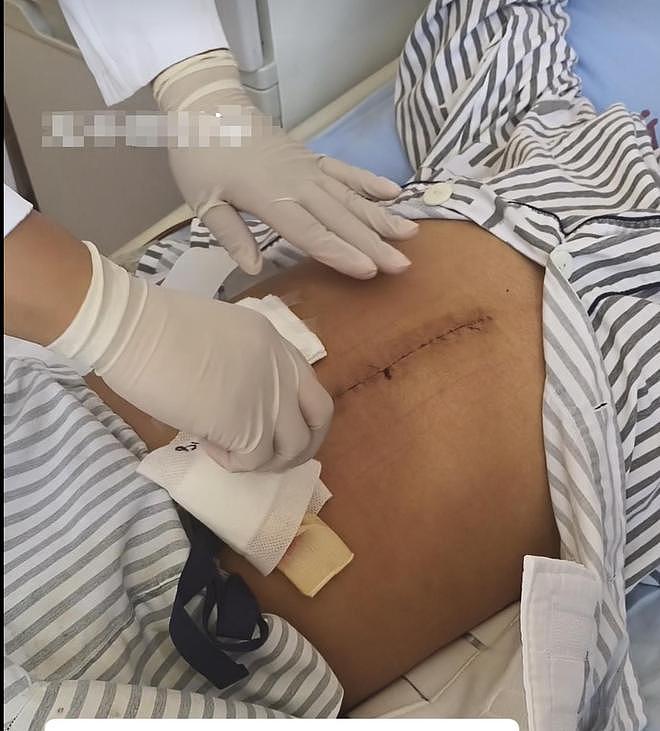 奶奶在哭,宝宝在笑!40天女婴重病,00后父亲割肝救女,术后这一幕让网友泪奔(组图) - 4