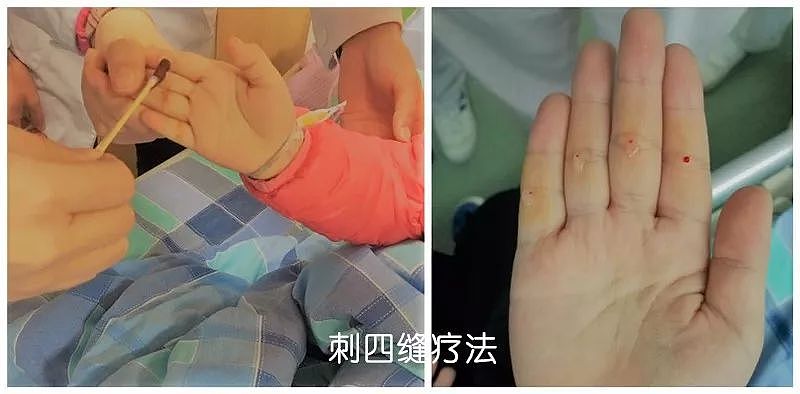 惨不忍睹！9岁女儿张开嘴，知名女演员愁坏了，网友：同款焦虑（组图） - 15