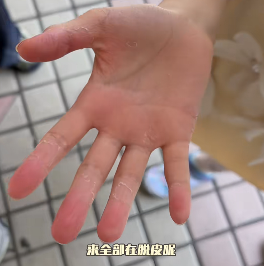 惨不忍睹！9岁女儿张开嘴，知名女演员愁坏了，网友：同款焦虑（组图） - 1