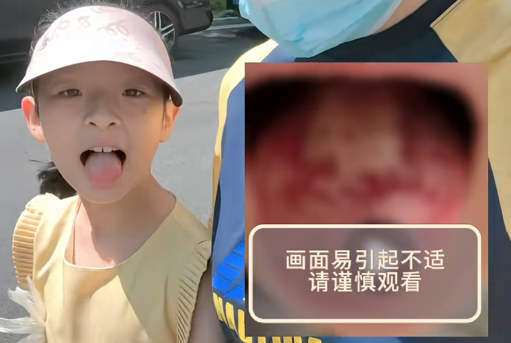 惨不忍睹！9岁女儿张开嘴，知名女演员愁坏了，网友：同款焦虑（组图） - 2
