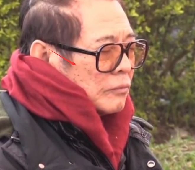 李连杰、吕颂贤连曝病重 | 港台前“大侠”们现状不佳?各有原因(组图) - 8