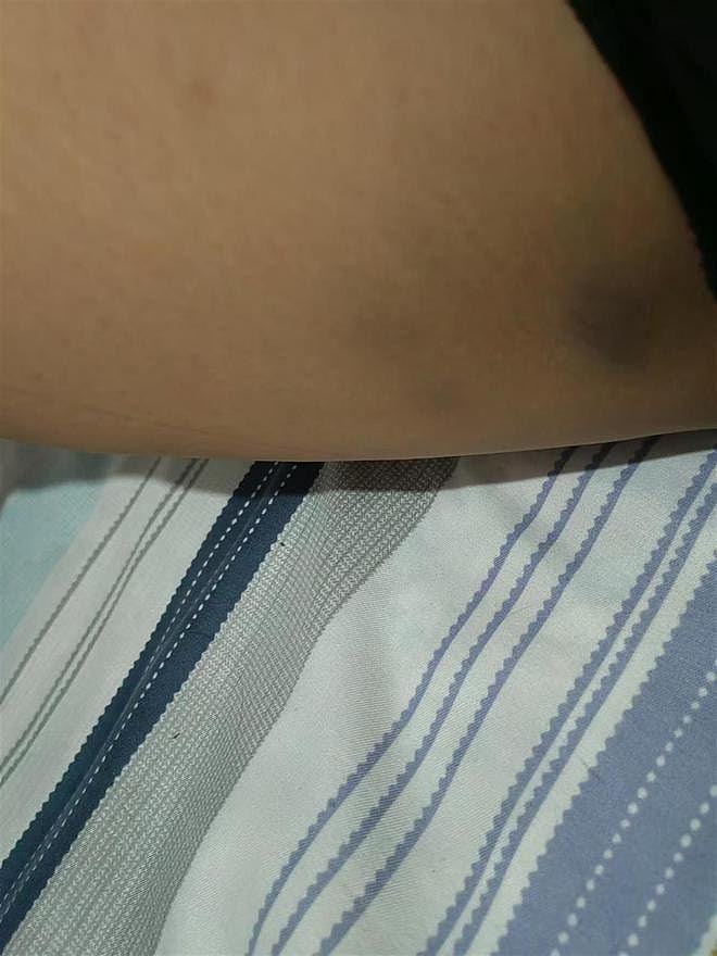 河北25岁女子惨遭家暴全身伤痕，致死悲剧为何一再上演？（组图） - 9
