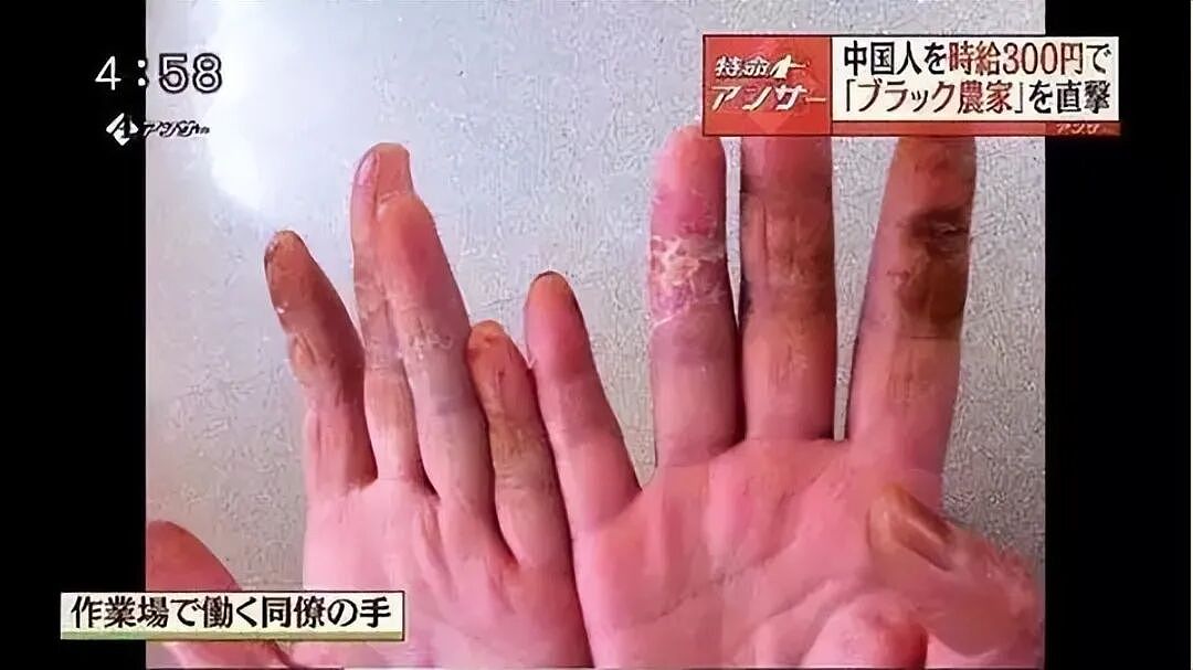 毒打、性骚扰，比缅北更像人间地狱，35万研修生沦为现代奴隶（组图） - 6