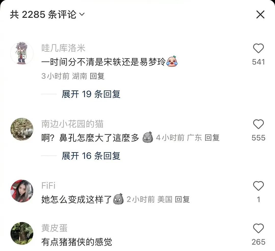宋轶的脸到底怎么了？她一句话让全网炸锅（组图） - 5