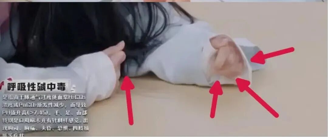 11岁男孩赶作业急出“中毒”症状,网红直播也发生过!医生提醒:不分年龄,严重可致命(组图) - 3