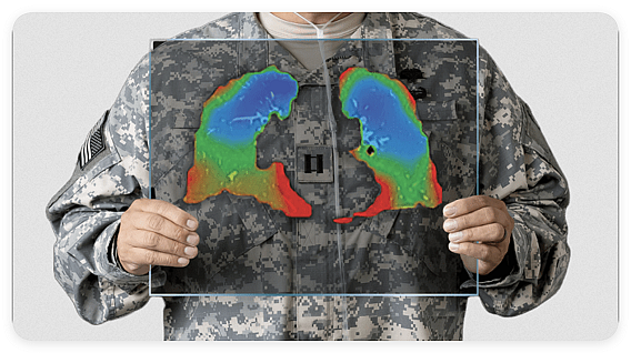 【异动股】4DMEDICAL (ASX：4DX) 肺部成像通气灌注产品CT：VQ获得美国FDA批准上市 股价暴涨36% - 4