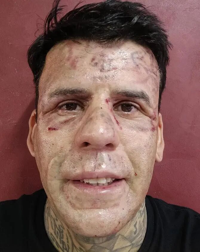“巴西文身哥”当年全身文满,现在却要全部洗掉!老老实实找个班上...(组图) - 10