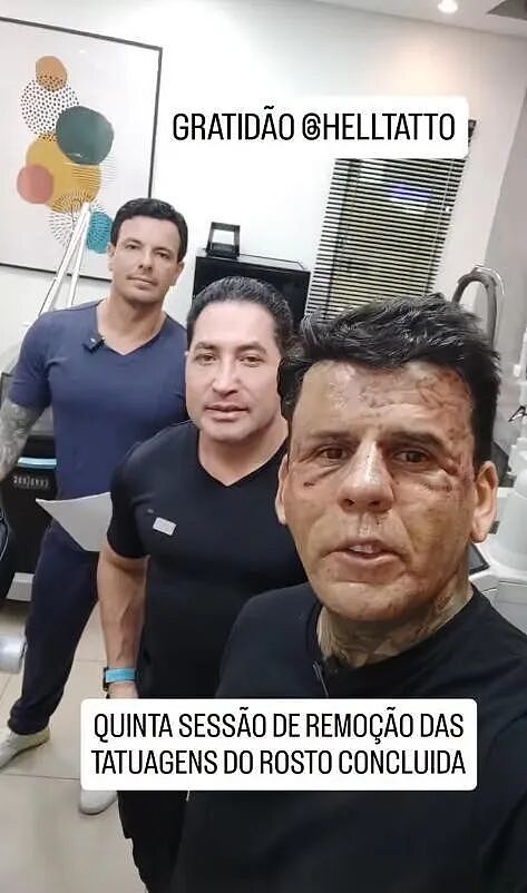 “巴西文身哥”当年全身文满,现在却要全部洗掉!老老实实找个班上...(组图) - 11