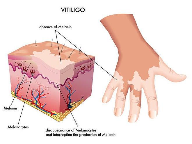 【涨知识】鼻毛总“窜”出来的男人，暗示了啥？为什么鼻毛会变白（组图） - 5
