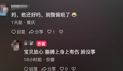 安徽热心女给被撞倒男孩撑伞，网友却被男孩颜值惊呆！网友：帅得出事了还以为在摆拍（视频/组图） - 7