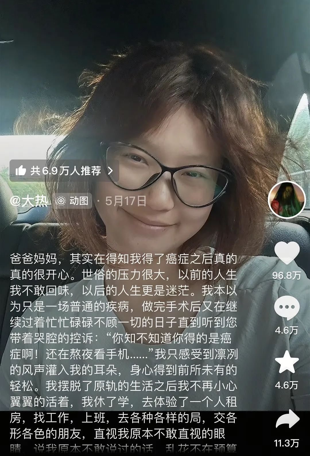 “21岁，确诊癌症，我好开心”（组图） - 2