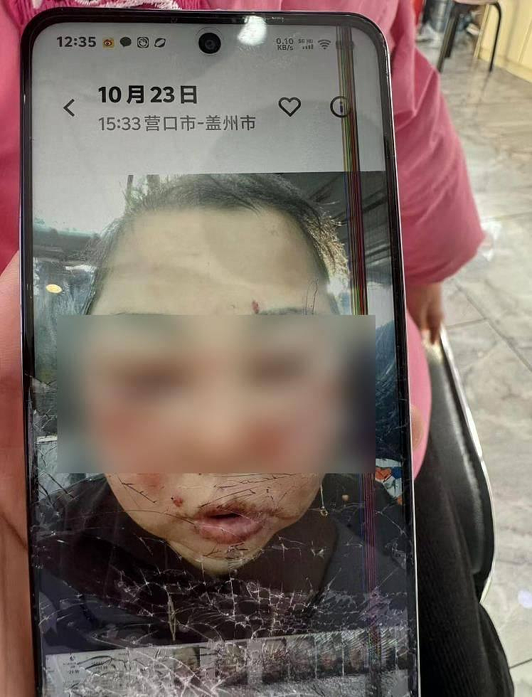 多说一句话都要被打！黑龙江女子遭前夫家暴，直肠破裂抢救无效死亡（组图） - 1