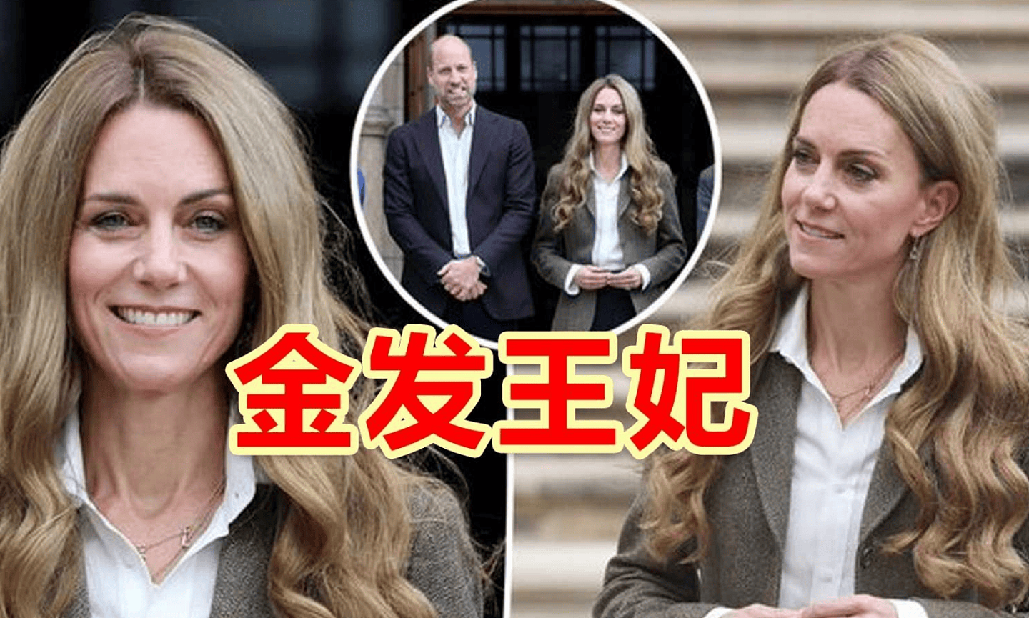 凯特王妃否认因化疗导致脱发：化妆师离职才是主因（组图） - 1