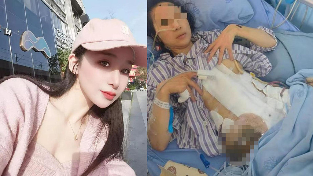 女子2年遭家暴16次案二审维持原判，前夫获刑11年（图） - 1