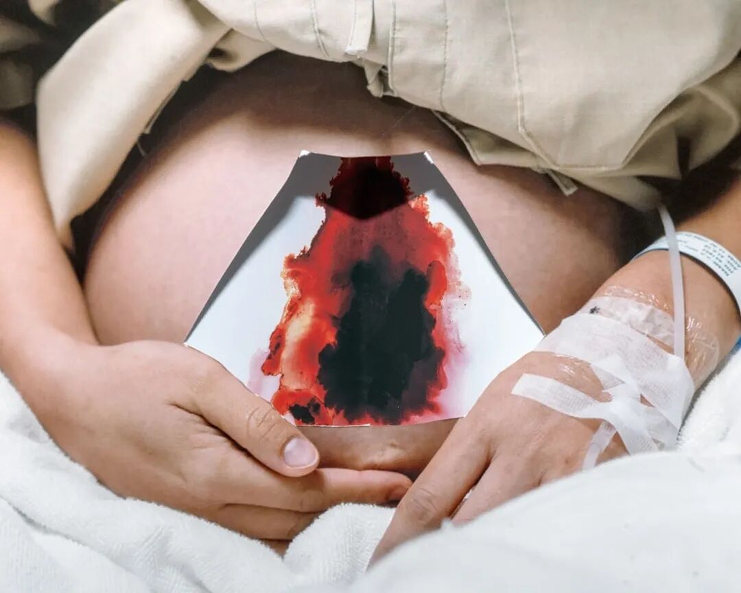 儿子在代孕妈妈肚里夭折，她直接疯了！人肉、起诉、爆地址，疯狂报复代孕妈...（组图） - 6