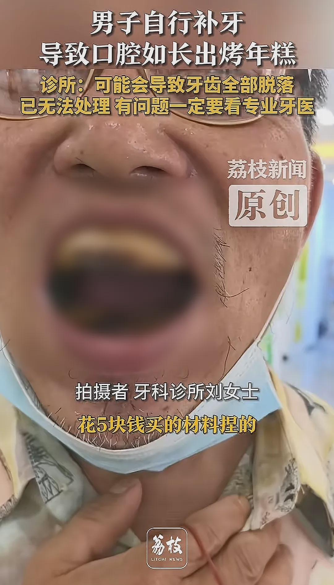 “种上一口牙,含着一辆车!”热搜上天津大爷嘴里“长年糕”事件,真的笑不出来(组图) - 1