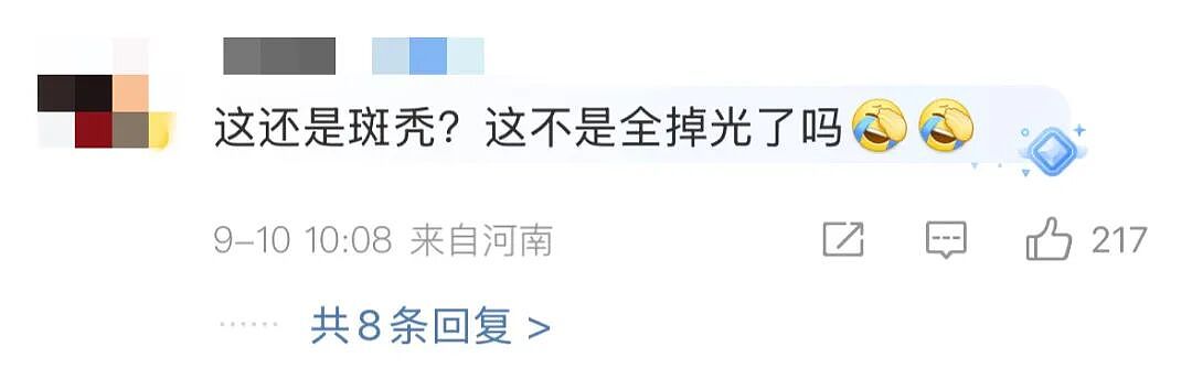 20岁女孩短短一个月头发、眉毛、腋毛全掉光，理由令人心疼，网友：不值得（视频/组图） - 7