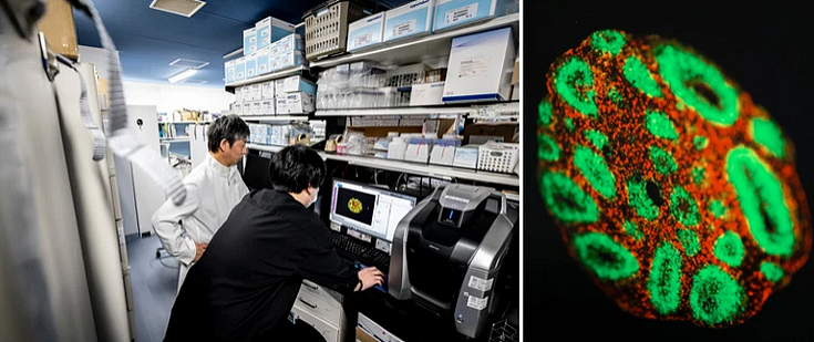 中国游客赴日热门医疗项目暴雷！50岁女性注射干细胞后死亡，日本政府紧急叫停（组图） - 5