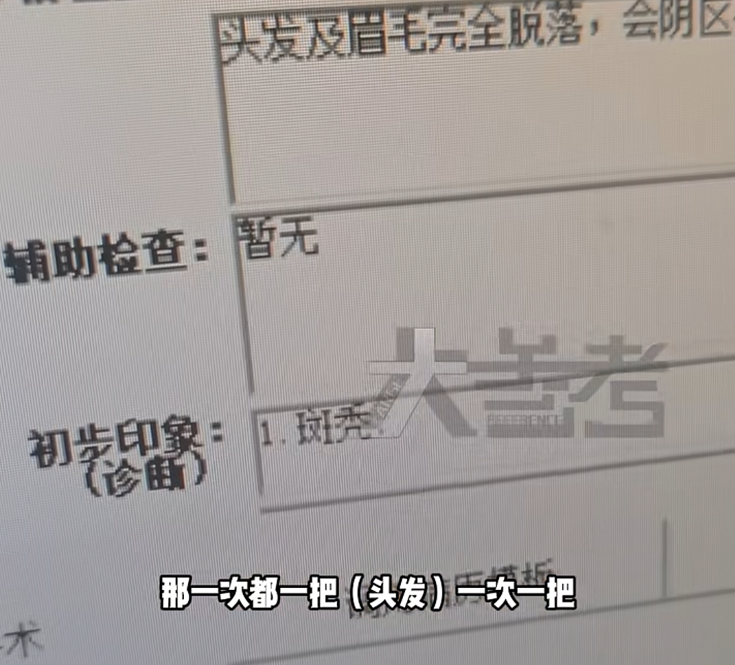20岁女孩短短一个月头发、眉毛、腋毛全掉光，理由令人心疼，网友：不值得（视频/组图） - 2