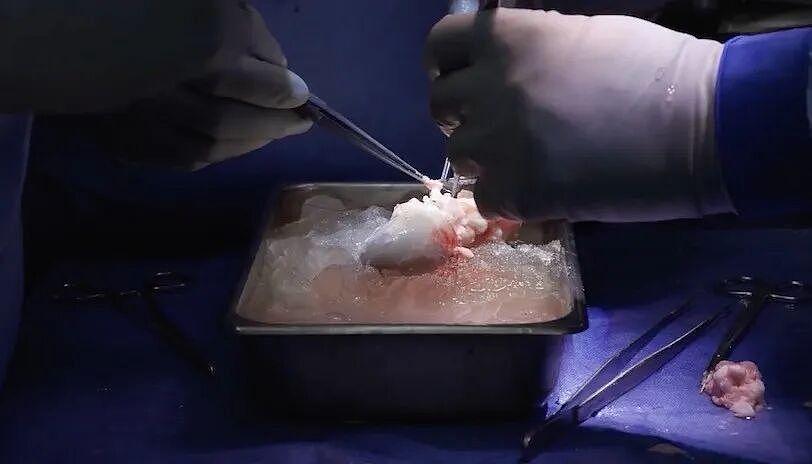 创纪录！男子移植猪肾脏健康存活6个月，跨物种器官移植奇迹（组图） - 7
