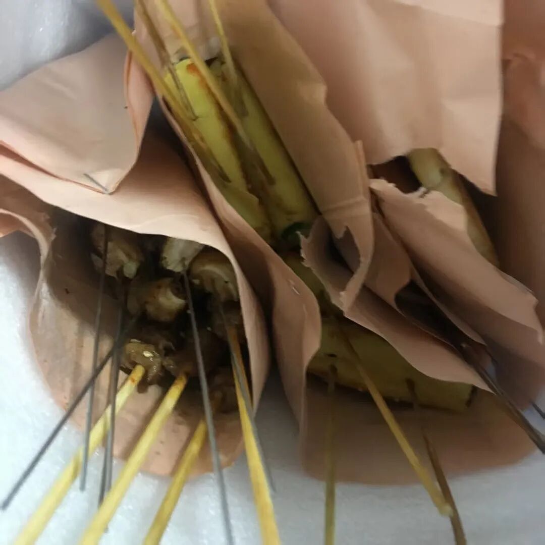 “仙女管”插胃,正毁掉年轻女孩(组图) - 14